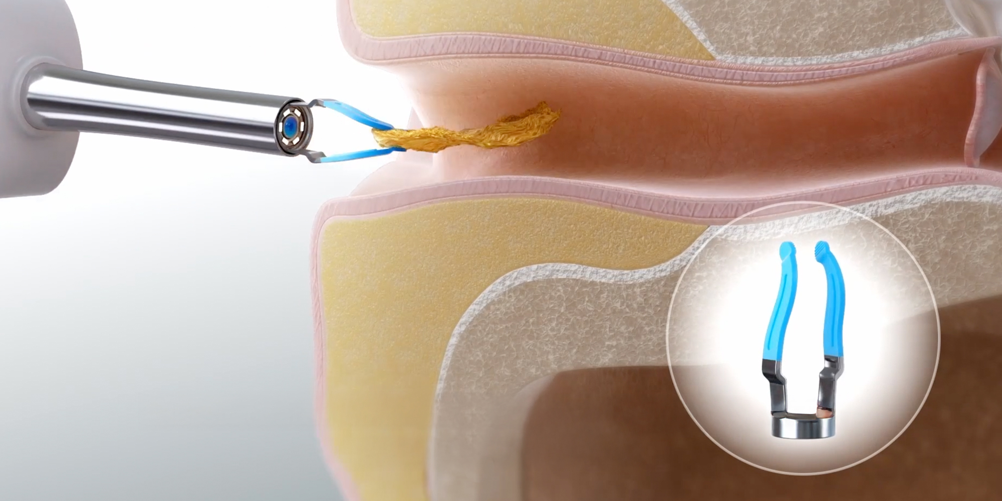 width=100% Urządzenie do czyszczenia uszu Bebird EarSight Plus R37R - biały